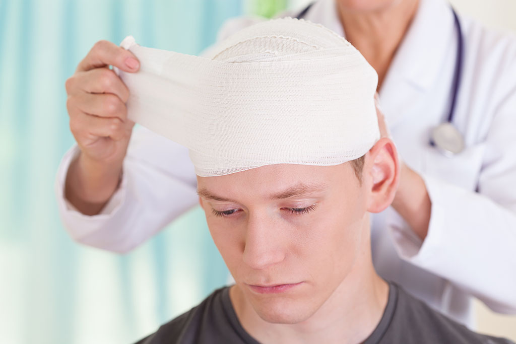 6 Myths About Concussions
