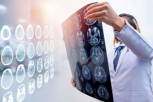 Brain Injury